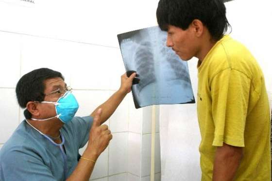 Entre el 15 y el 29 de marzo se desarrollarán actividades preventivas contra la Tuberculosis