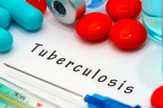 Brindan hoy una charla informativa sobre Tuberculosis en la UNSA