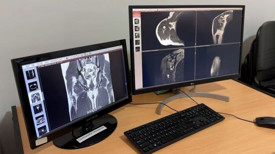 Entró en funcionamiento un nuevo resonador magnético en Tomografía del Estado