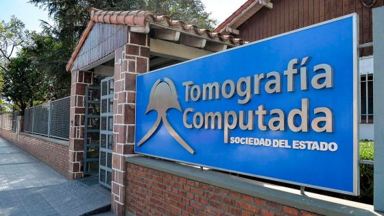 Entró en funcionamiento un nuevo resonador magnético en Tomografía del Estado