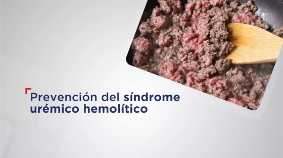 La buena cocción de carnes y el lavado adecuado de los vegetales previenen el síndrome urémico hemolítico