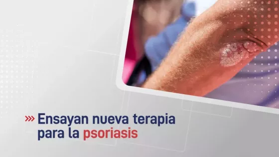 Personas con psoriasis pueden mejorar la salud de la piel con una nueva terapia