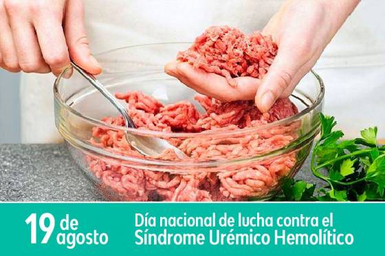 El Síndrome Urémico Hemolítico se produce por alimentos contaminados