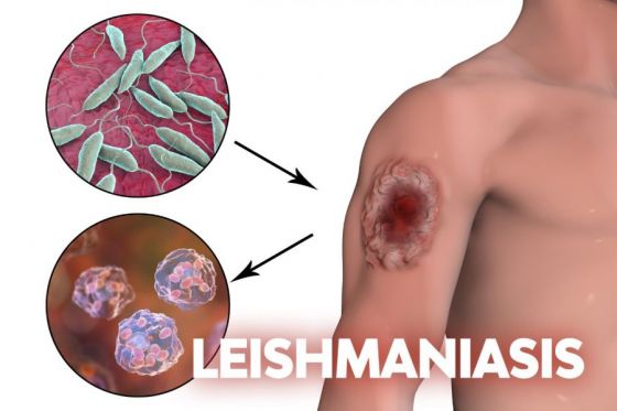 Las leishmaniasis son enfermedades endémicas que afectan al noroeste argentino