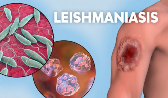 Las leishmaniasis tienen tratamiento médico y cura