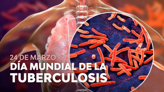 Salta es referente en la detección de casos de tuberculosis