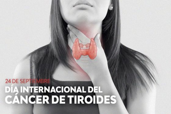 La edad, el sexo y la exposición a la radiación aumentan el riesgo del cáncer de tiroides