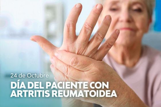 Se conmemora hoy, el Día del Paciente con Artritis Reumatoidea en Argentina