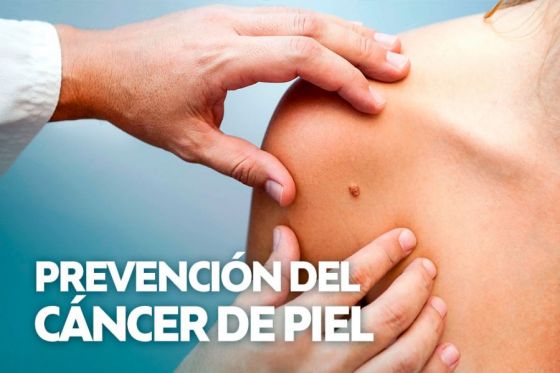 En el hospital Señor del Milagro se hará detección de cáncer de piel