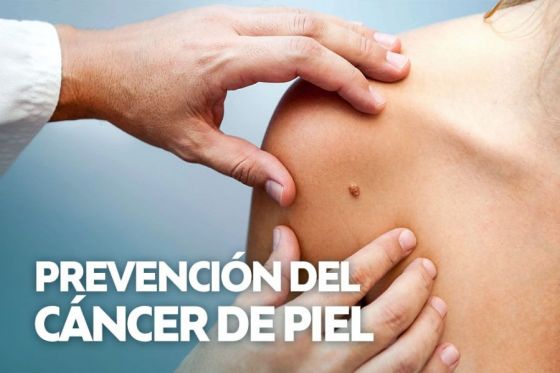 Realizan detección de lesiones cancerosas en la piel en el hospital Señor del Milagro