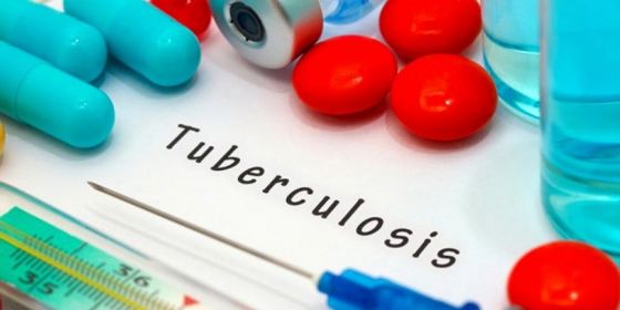 Salta participa en un estudio sobre el costo de la tuberculosis para el paciente y su familia