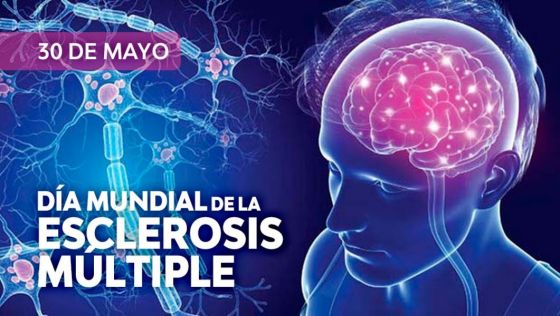 El diagnóstico temprano posibilita enlentecer el progreso de la esclerosis múltiple