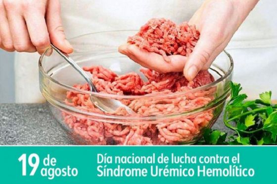 La correcta cocción de las carnes previene el síndrome urémico hemolítico