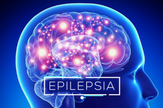 El 70% de los pacientes con epilepsia puede tener una vida plena bajo un tratamiento adecuado