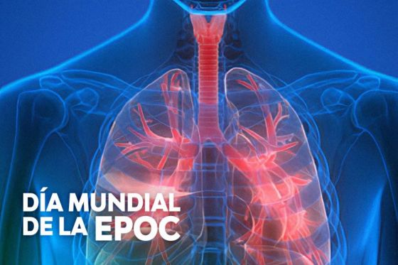 La inhalación del humo de tabaco es la principal causa de la EPOC