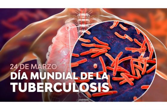 En el año 2022 se diagnosticaron 852 nuevos casos de tuberculosis en la provincia