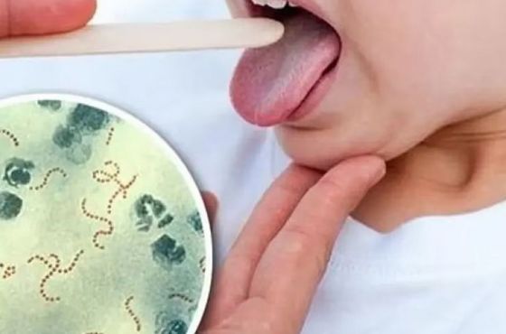 Salud informa la situación epidemiológica de Streptococcus pyogenes