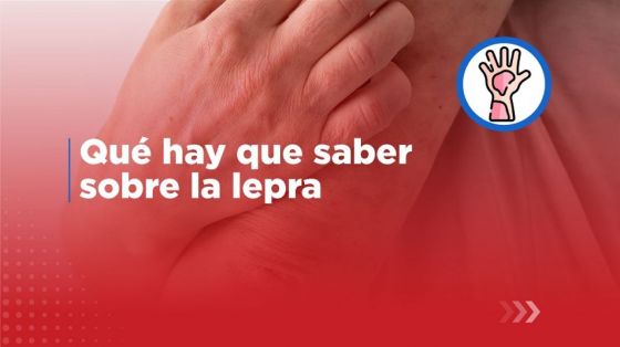 En Salta hay 14 pacientes en tratamiento por lepra con medicación gratuita