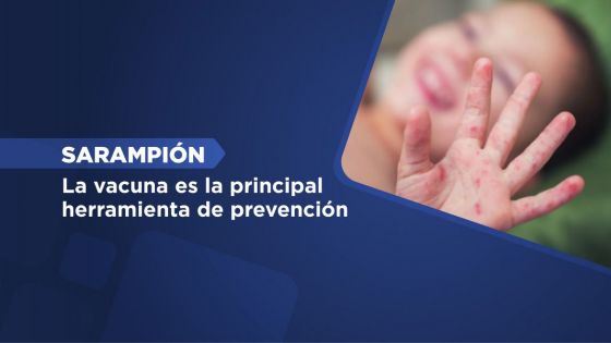 Sarampión: la vacuna es la principal herramienta de prevención