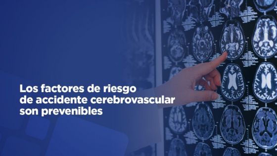 Los factores de riesgo de accidente cerebrovascular son prevenibles