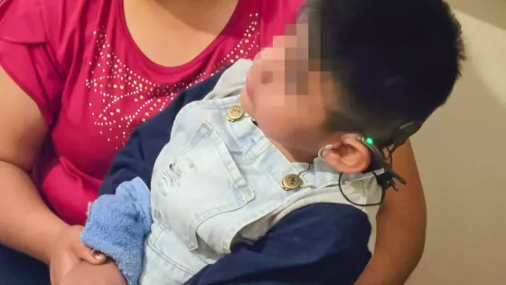 Niños detectados con hipoacusia recibirán implante coclear en forma gratuita