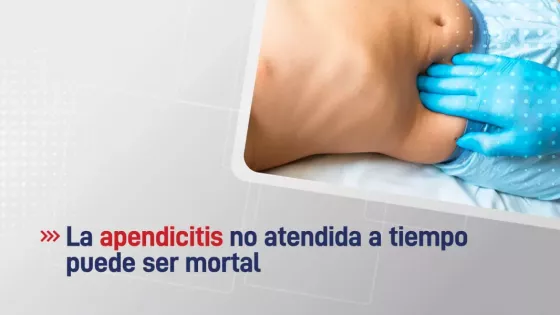 La apendicitis no atendida a tiempo puede derivar en peritonitis y ser mortal